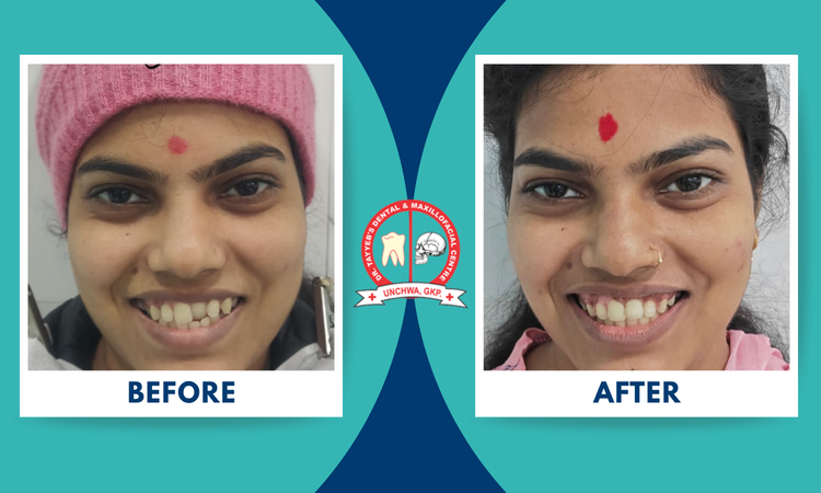 braces treatment at dr tayyeb's